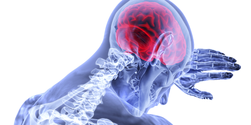 Udar mózgu – jak zapobiegać, jak rozpoznać?