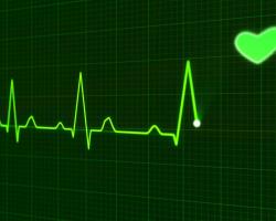 Migotanie przedsionków – nowa epidemia w kardiologii 