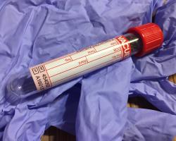 Pielęgniarka epidemiologiczna czuwa nad przestrzeganiem zasad higieny w szpitalu