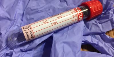 Pielęgniarka epidemiologiczna czuwa nad przestrzeganiem zasad higieny w szpitalu
