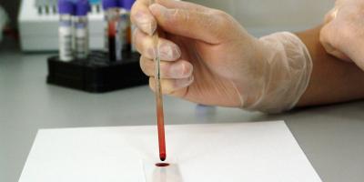 Choroby krwi: anemia, hemofilia, białaczka