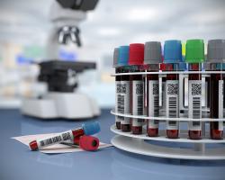 Wirówka laboratoryjna - na co zwrócić uwagę podczas jej kupna?