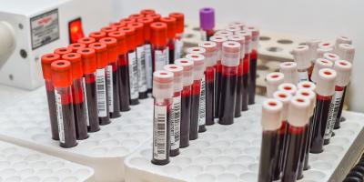 Bladość i częste infekcje mogą być objawem białaczki? 