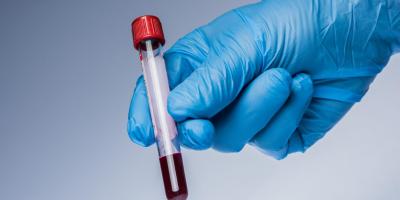 Kiedy zrobić test w kierunku HIV?