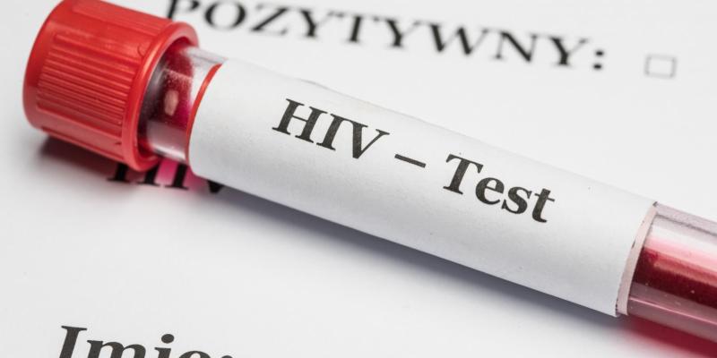 HIV nie zniknął. Wiesz, jak uniknąć zakażenia?